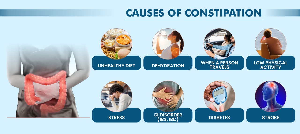 Causes-of-Constipation