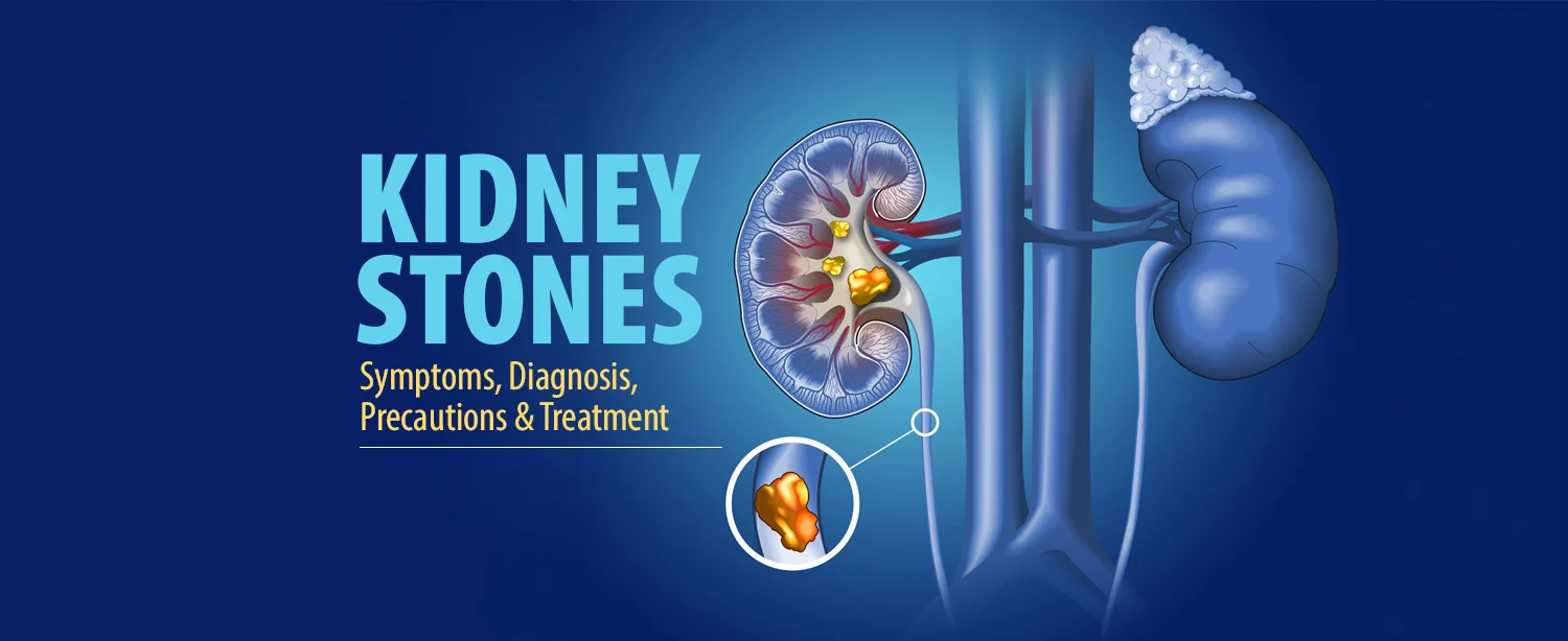 Kidney-stones
